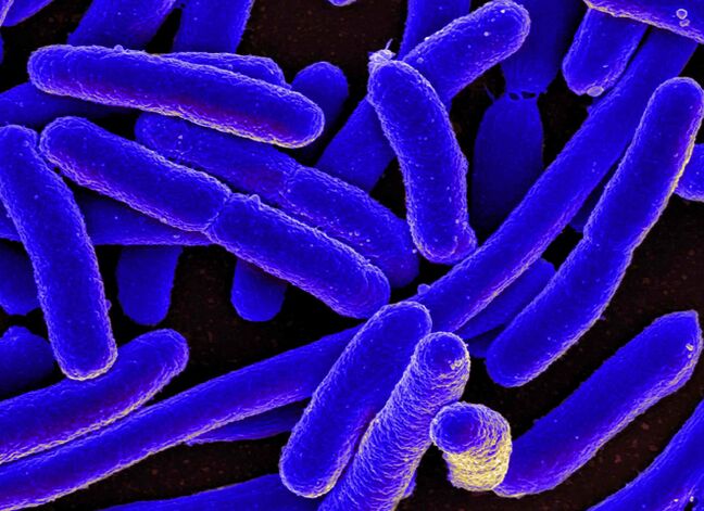 E. coli most often provokes the development of cystitis in women